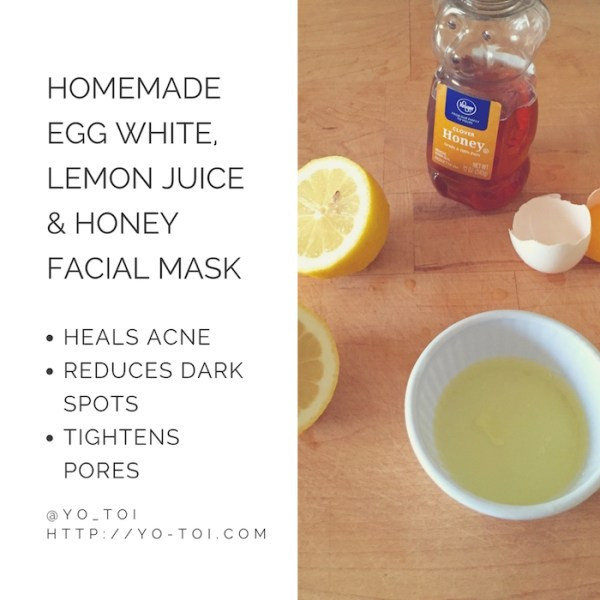 Acne Face Masks DIY
 Egg White Lemon Juice & Honey Facial Mask for Acne Scars