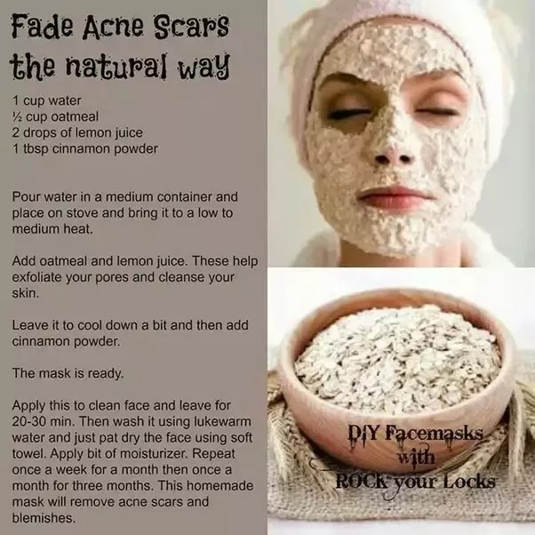 Acne Face Masks DIY
 What are the best DIY face masks for acne scars Quora