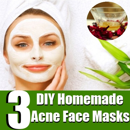 Acne Face Masks DIY
 Top 3 DIY Homemade Acne Face Masks