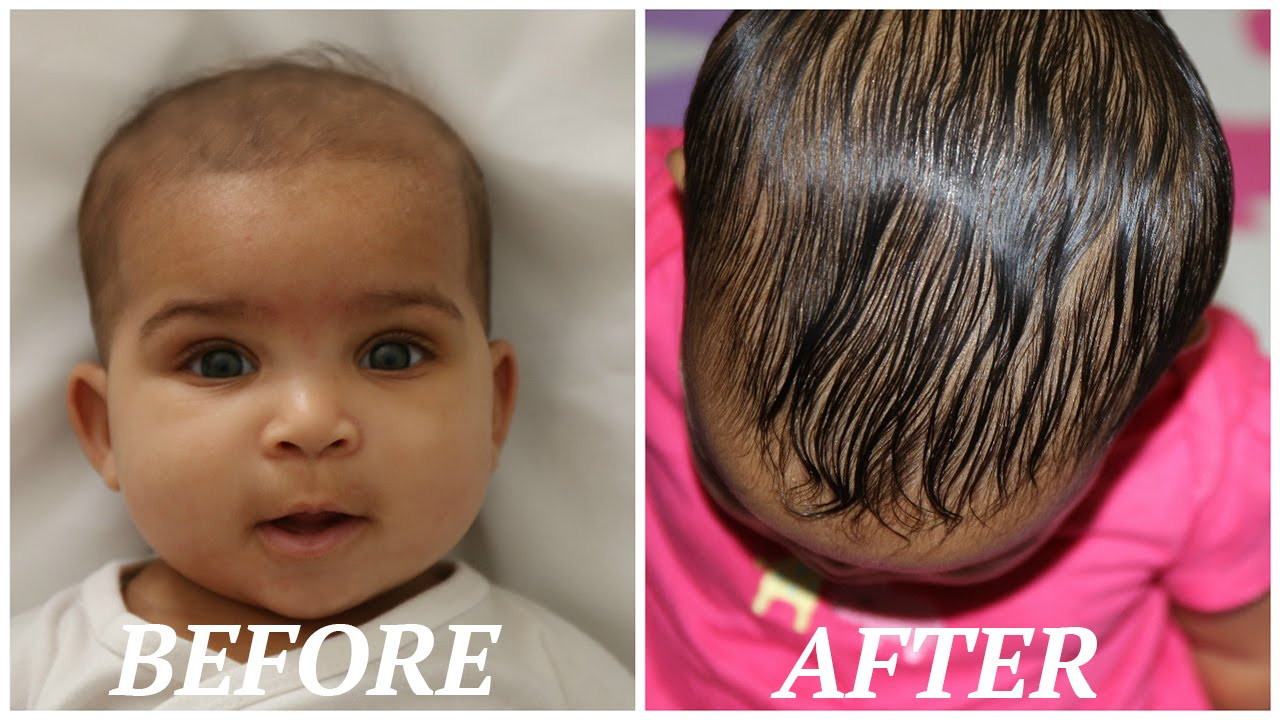 Baby Hair Growth
 HOW TO GROW YOUR BABIES HAIR BACK FAST