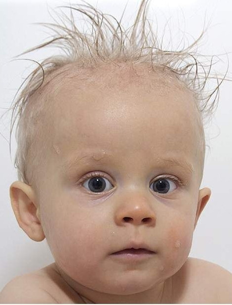 Baby Hair Growth
 Newborn Baby hair loss causesNewborn Babies Natural Care