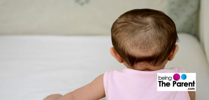 Baby Hair Growth
 Premature Balding In Children Causes And Treatments
