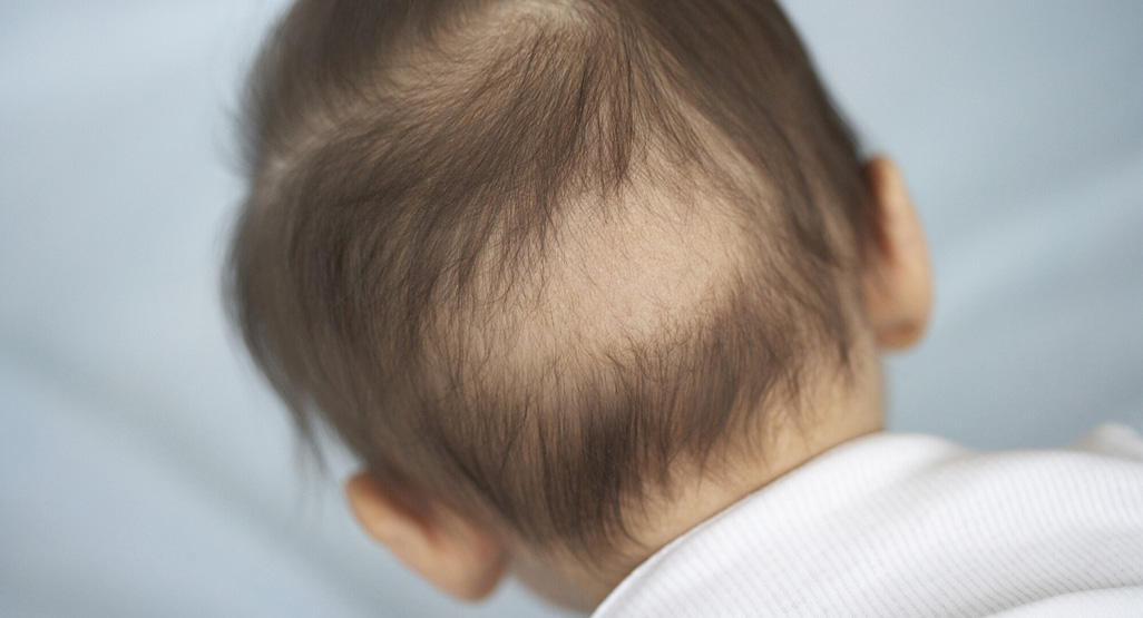 Baby Hair Growth
 Hair loss in babies