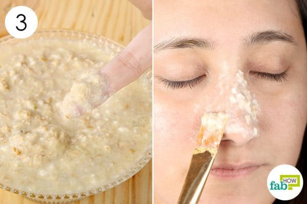 Best DIY Blackhead Mask
 9 DIY Face Masks to Remove Blackheads and Tighten Pores
