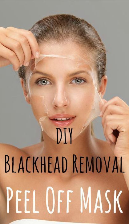 DIY Blackhead Peel Mask
 Vingle Effective Blackhead Peel f Mask DIY Face Mask
