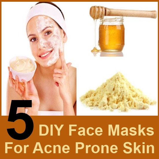 DIY Face Mask For Acne And Oily Skin
 5 DIY Face Masks For Acne Prone Skin