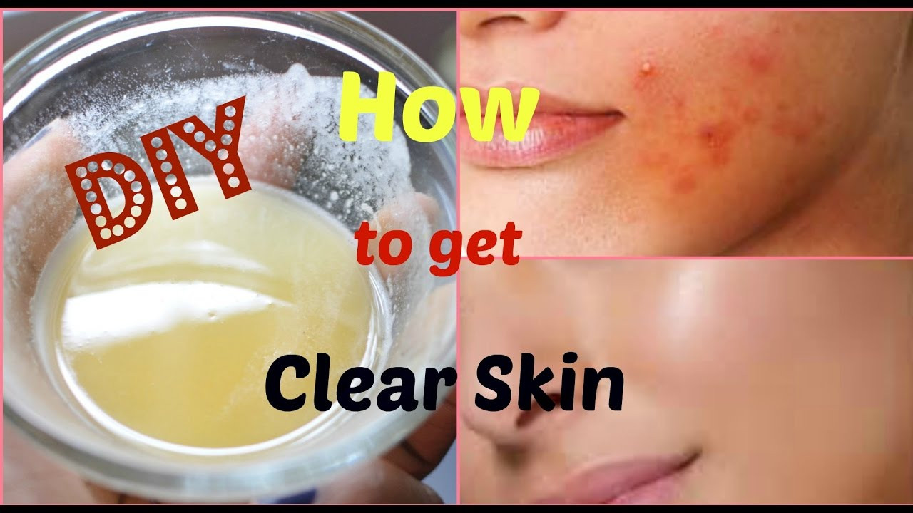DIY Face Mask For Clear Skin
 DIY Face Mask to Get Rid of Acne & Acne Scars FAST