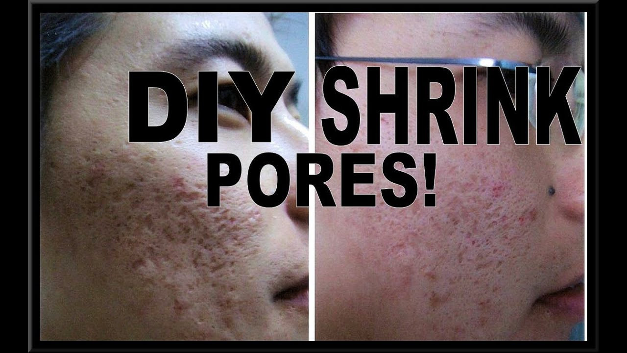 DIY Face Mask For Pores
 HOW TO SHRINK PORES DIY PORE MINIMIZING MASK