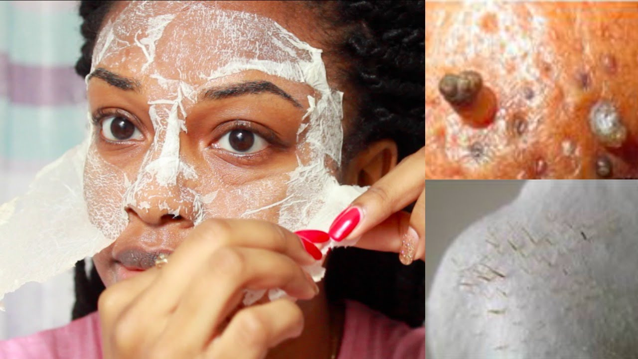 DIY Peel Off Face Mask For Blackheads
 EASY DIY Egg Blackhead Remover Peel f Mask