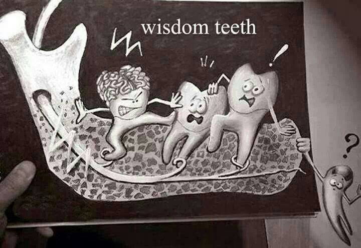 Funny Wisdom Teeth Quotes
 17 Best images about Funny Dental Stuff on Pinterest