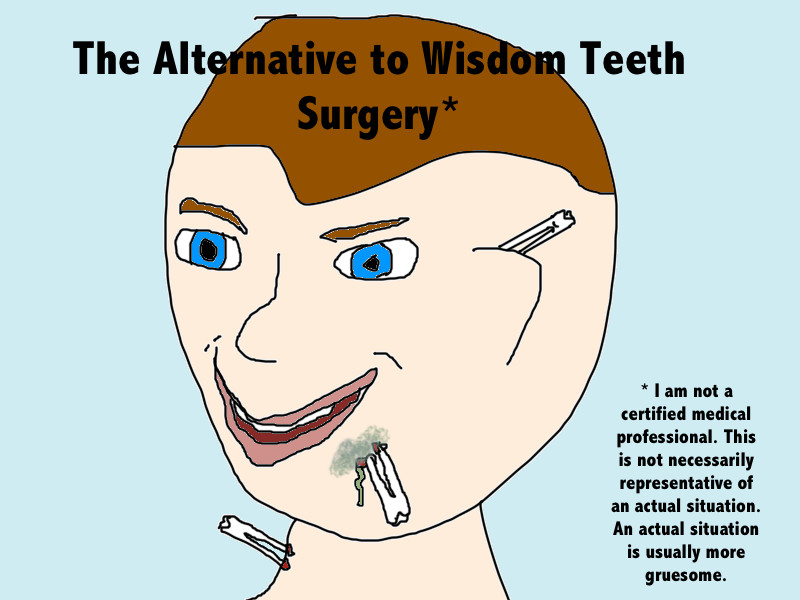 Funny Wisdom Teeth Quotes
 Wisdom Teeth are Not Your Friend