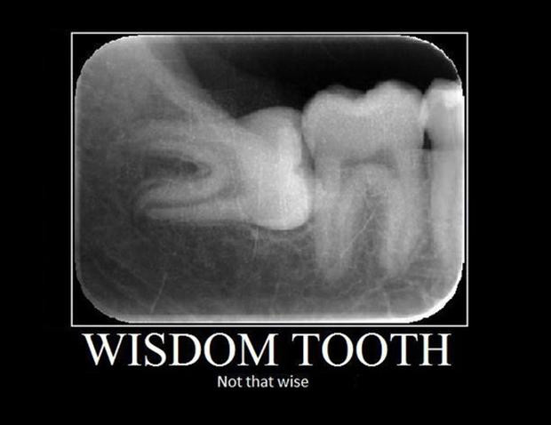 Funny Wisdom Teeth Quotes
 Inspirational Quotes About Teeth QuotesGram