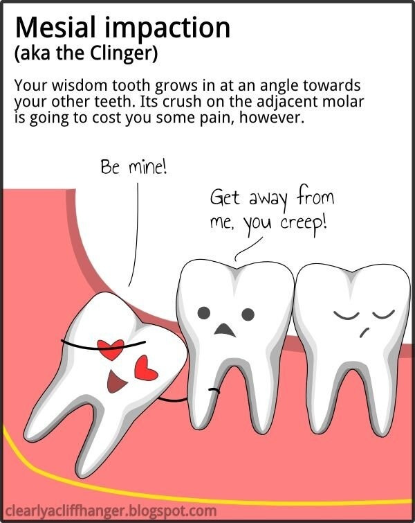 Funny Wisdom Teeth Quotes
 147 best Dental Cartoons & Humor images on Pinterest