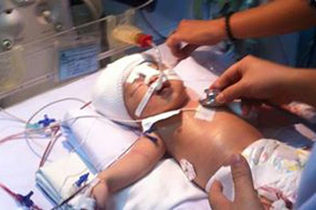 Gift For Sick Baby In Hospital
 15 Ways The Baby May Not Survive To See It s First Birthday