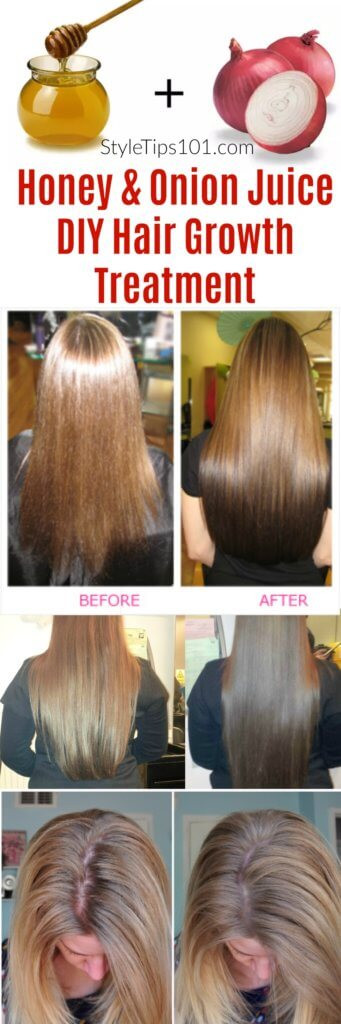 Hair Growth Treatment DIY
 ion Juice & Honey DIY Hair Growth Treatment