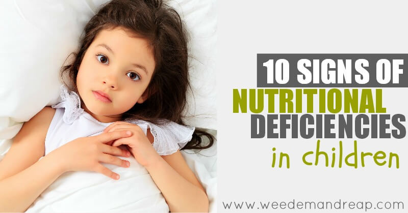Hair Loss In Children Vitamin Deficiency
 10 Signs of Nutritional Deficiencies in Children