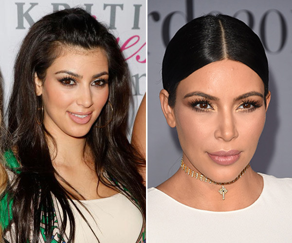 Kim.Kardashian Baby Hair
 Celebrity Hair Removal Laser Vectus Gets Rid Baby