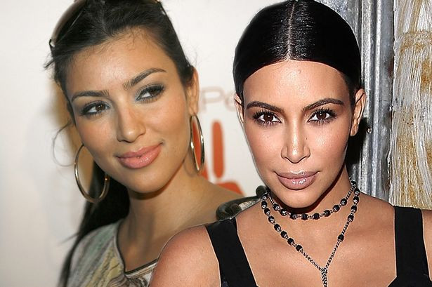 Kim.Kardashian Baby Hair
 Kim Kardashian admits she had hairline lasered to