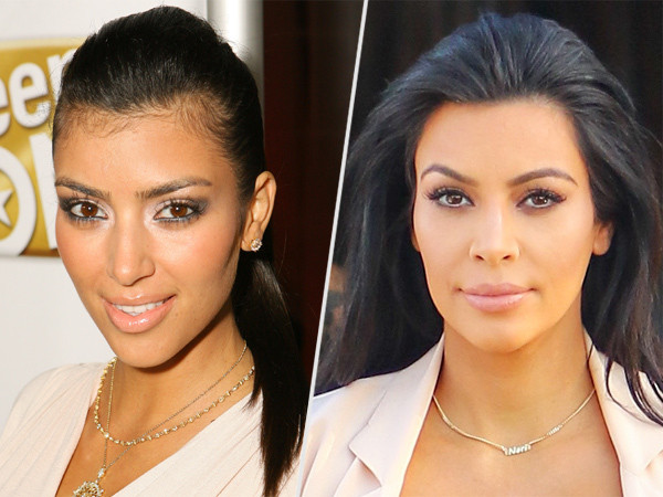 Kim.Kardashian Baby Hair
 Kim Kardashian on Hair Removal I Had Such a Hairy Neck