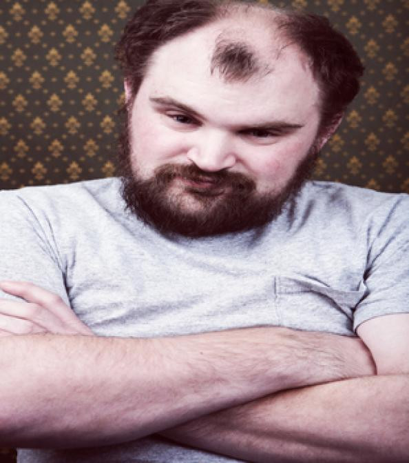 Male Pattern Baldness Hairstyle
 Your Diabolical Follicles Treating Male Pattern Baldness