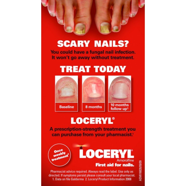 Pretty Nails Limerick
 Loceryl Fungal Nail Treatment Reviews Nail Ftempo